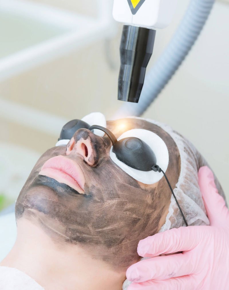 Clarion Center Laser Facial